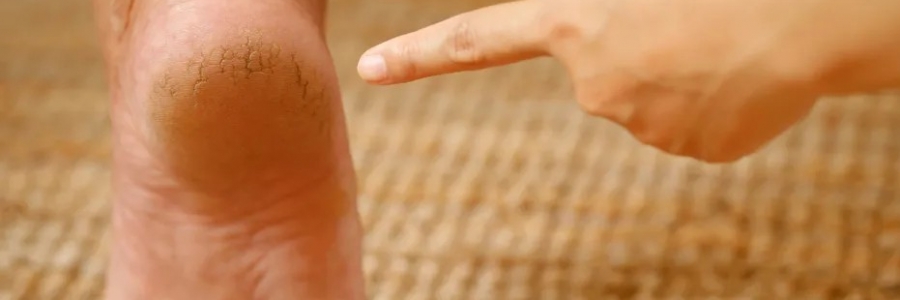 每天跺跺腳，從腳養(yǎng)到頭，越跺越年輕！